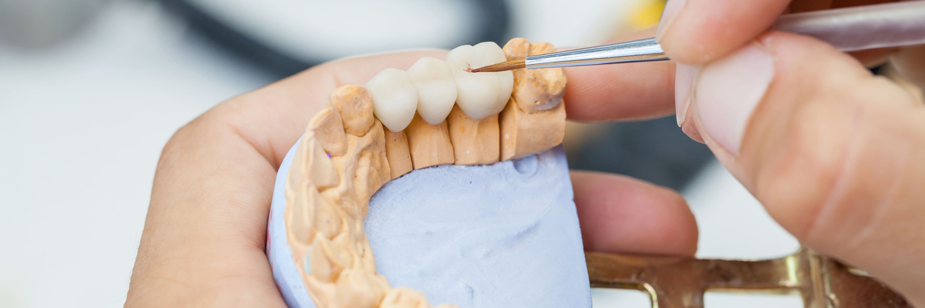 Dental technician fitting a porcelain bridge onto a plaster tooth model with tweezers