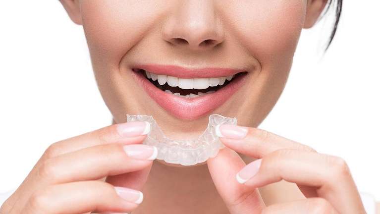 clear aligners in mona vale