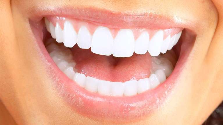 teeth whitening in mona vale