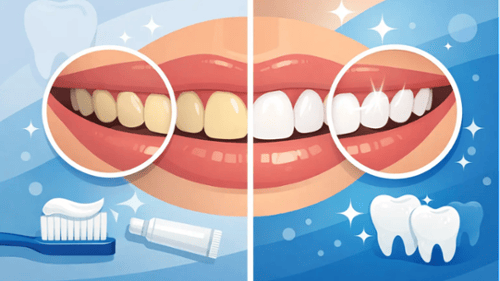 See what affects teeth whitening results and what to expect before and after professional whitening 