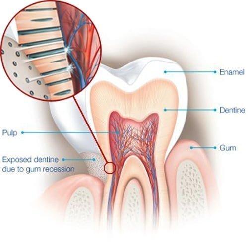 Dentist Mona Vale Blog Causes of Tooth Sensitivity