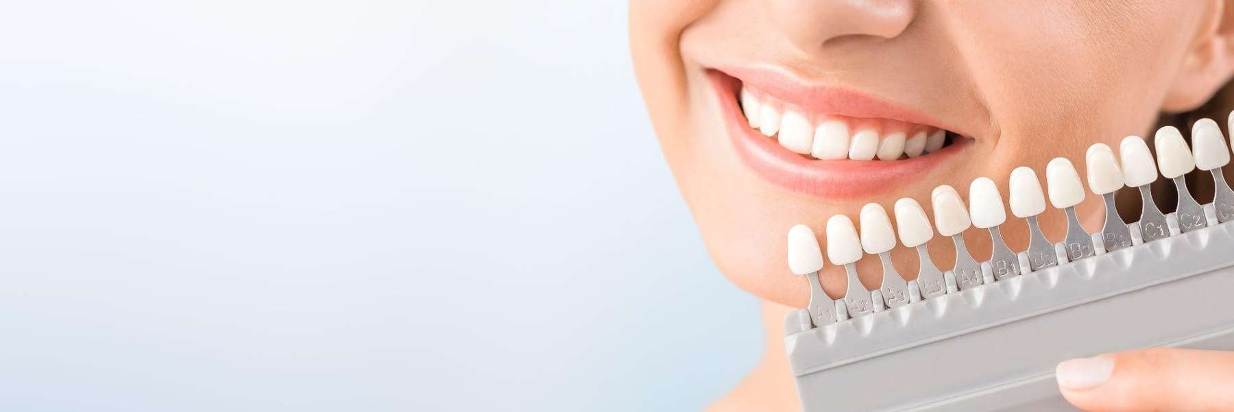 Woman teeth compared to a teeth shade chart in Mona Vale